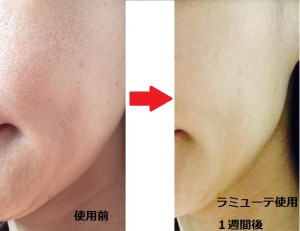 ラミューテ化粧品使用前使用後の肌-画像